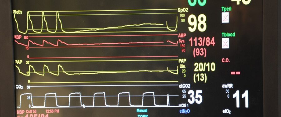A patient monitor showing vital-sign waveforms
